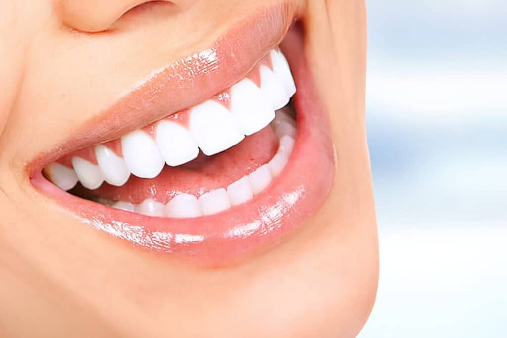 What to expect when getting Immediate Dentures Total Denture Care