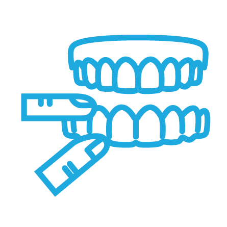 retainers